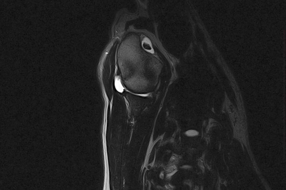 A small animal MRI scan