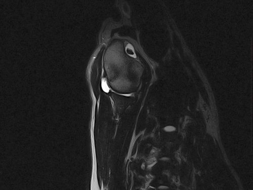 A small animal MRI scan