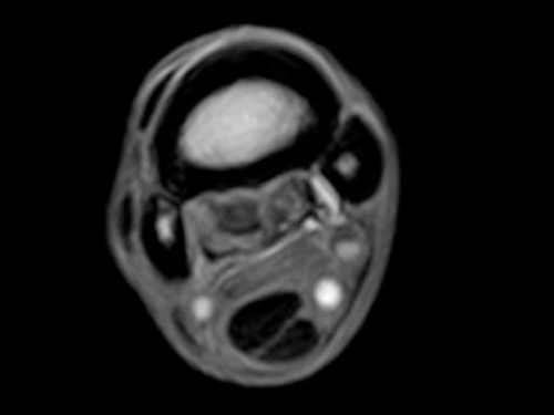 A cross-sectional Equine MRI scan