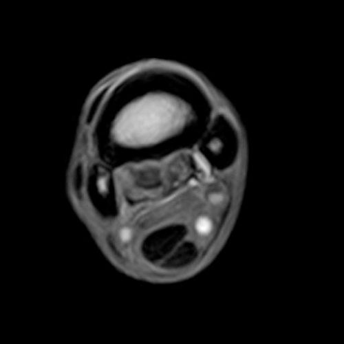 Standing Equine MRI for Horses Hallmarq Veterinary Imaging