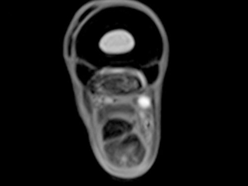 an Equine MRI image