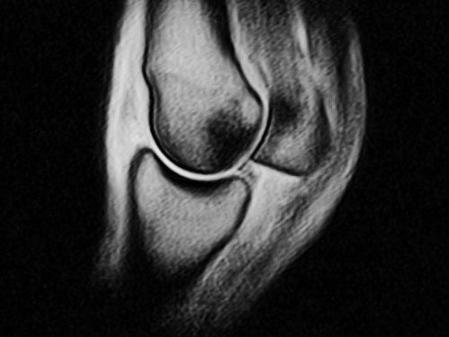 An Equine MRI scan of a joint