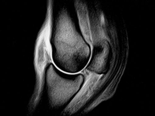 Equine MRI scan of a joint