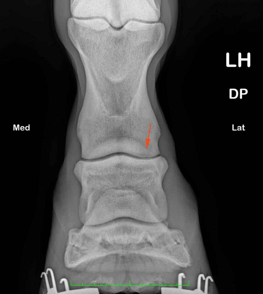 Radiograph showing lucency in the lateral condyle of the proximal phalanx (orange arrows) 