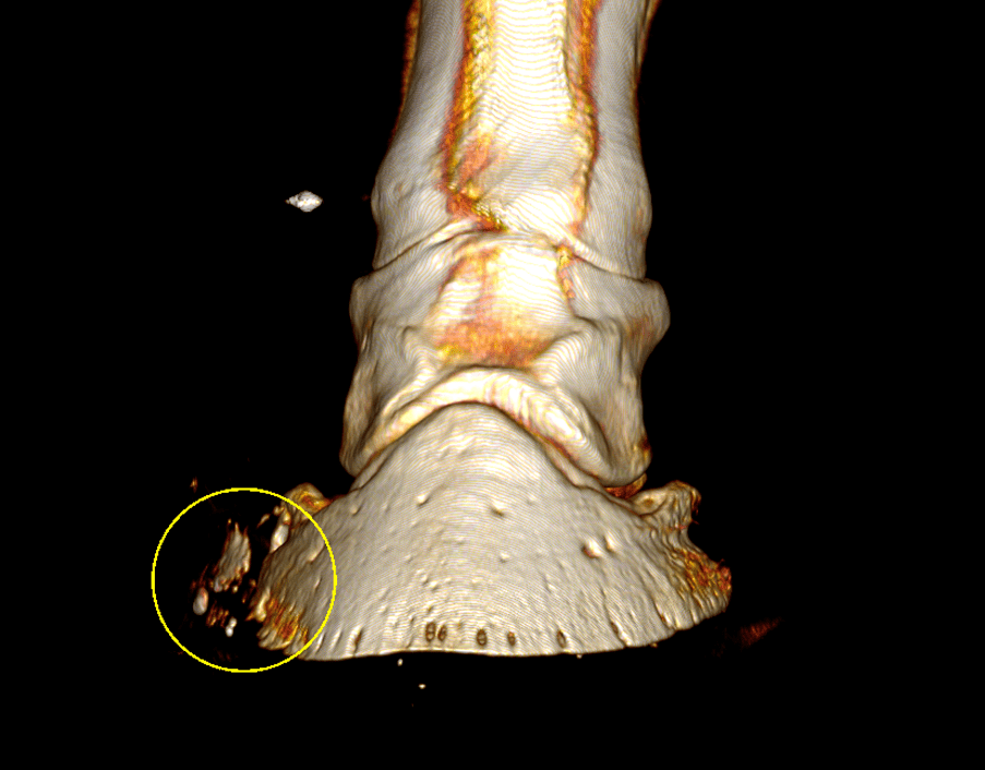 3D volume rendering CT image highlighting the foreign body in the lateral hoof wall 