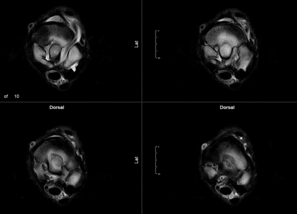 T2w FSE iNAV fetlock images