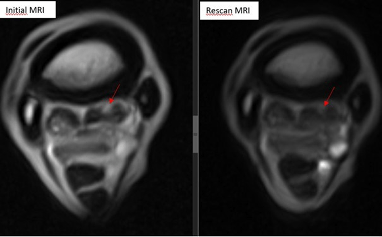 SMDC MRI rescan