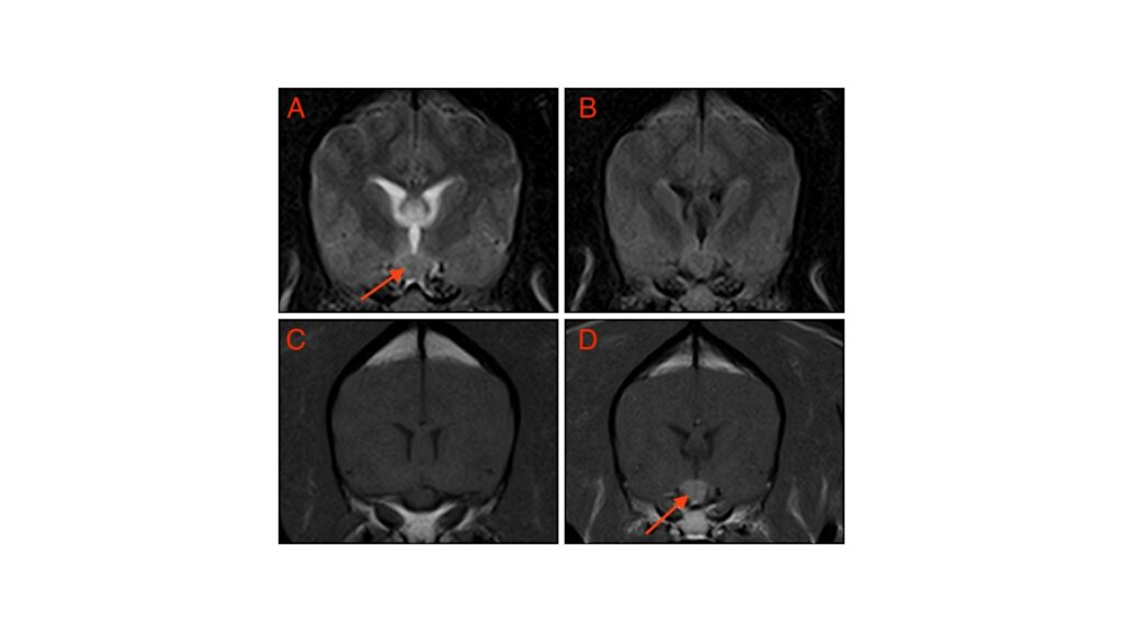 Optic neuritis or acute onsite blindness can be diagnosed with the use of MRI