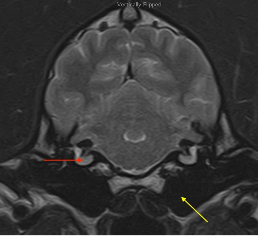 SAMRI Vestibular Disease