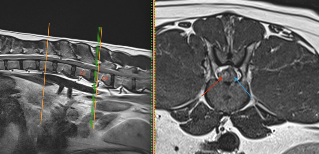 A veterinary MRI of a dog's lower back can be seen in this figure. The right side of the picture shows a cross-sectional view through the vertebral column at the L2-L3 disc space. The red arrow points to an intervertebral disc herniation, which is compressing the spinal cord (blue arrow).