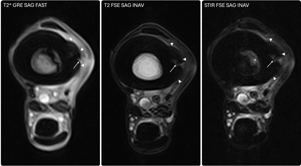 Transverse images of the third metatarsal bone highlighting equine exostoses