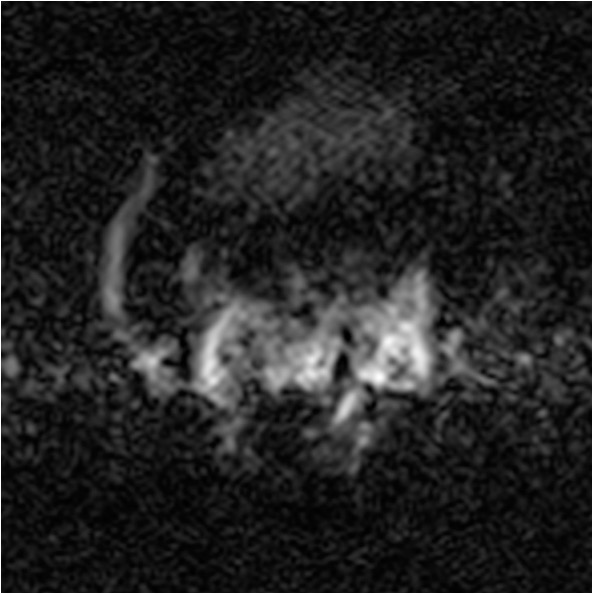 Standing equine MRI STIR image before the application of iNAV motion correction software.