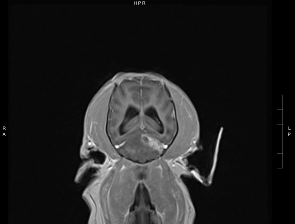 Intracranial strokes in dogs. An MRI T1 Post Contrast Dorsal Image shows variable contrast enhancement surrounding the T2 hypointense lesion and extending into the left cerebellar hemisphere.