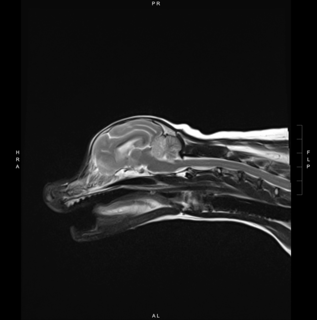 Intracranial canine stroke. MRI image showing T2/FLAIR hyperintensity surrounding the T2 hypointense lesion involving much of the left and right cerebellar hemispheres, seen in the cranial aspect of the cerebellum.