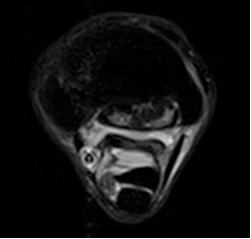 Standing equine MRI image with iNAV motion correction software applied
