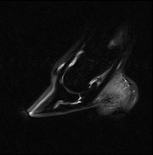 STIR sagittal MRI images showing the contralateral limb with a normal navicular bone for comparison.