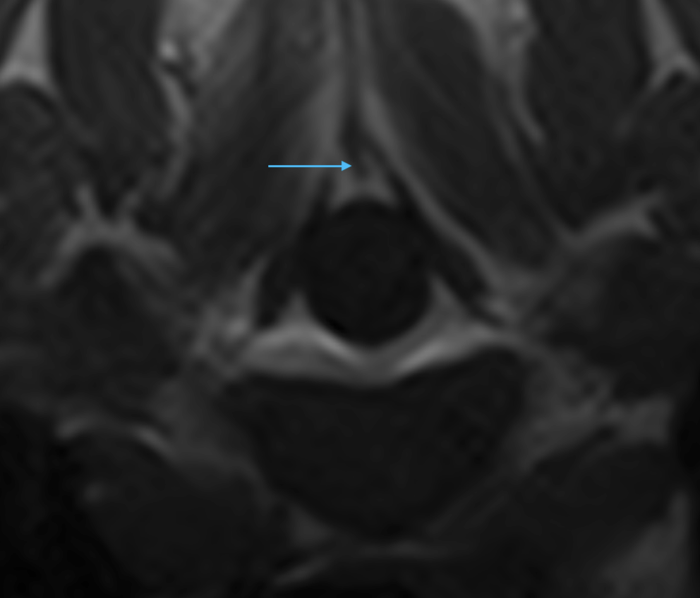 A 1.5T veterinary MRI showing a T1W transverse image of the vertebral column at the level of T3-T4.