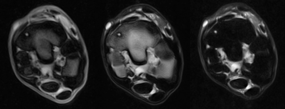 Hallmarq's iNAV for transformational imaging of the distal tarsus and as used by The Royal (Dick) School of Veterinary Medicine at the University of Edinburgh. 