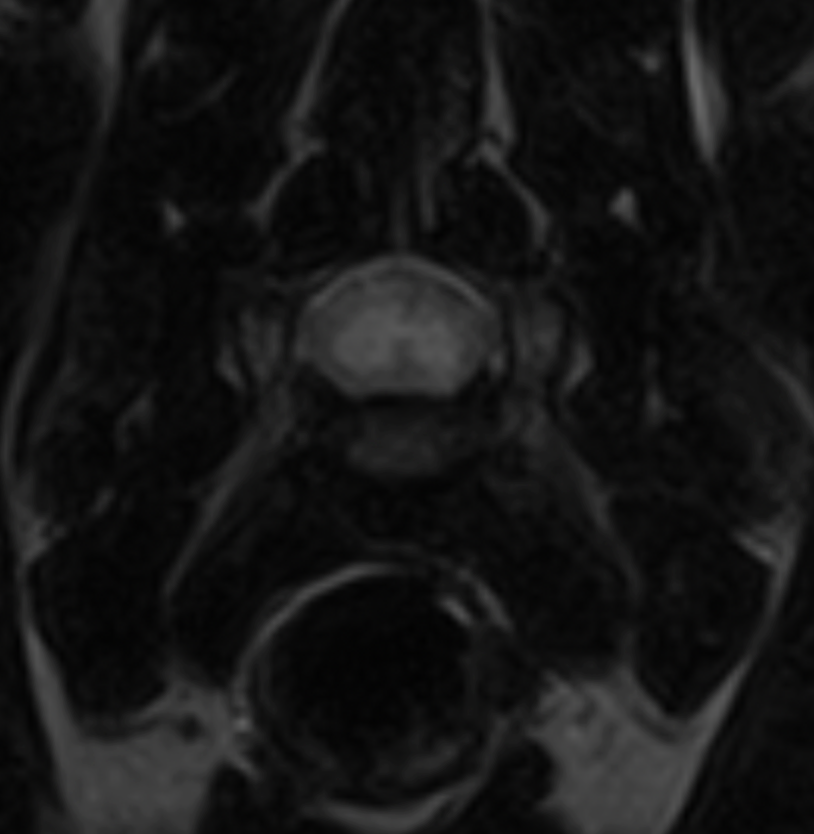 An MRI scan showing a T2-weighted transverse view of feline cervical spine at VERC Hawaii