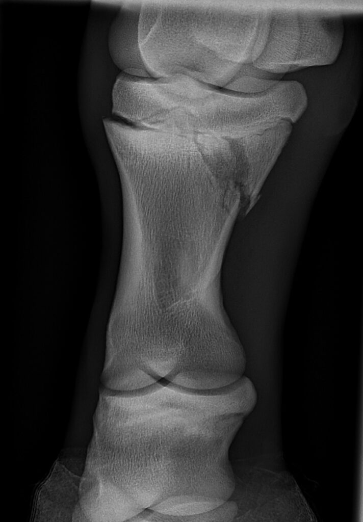 Figure 1:  DMPaL oblique radiograph of the left hind limb demonstrating a fracture involving the lateral aspect of the physis of the proximal phalanx. 